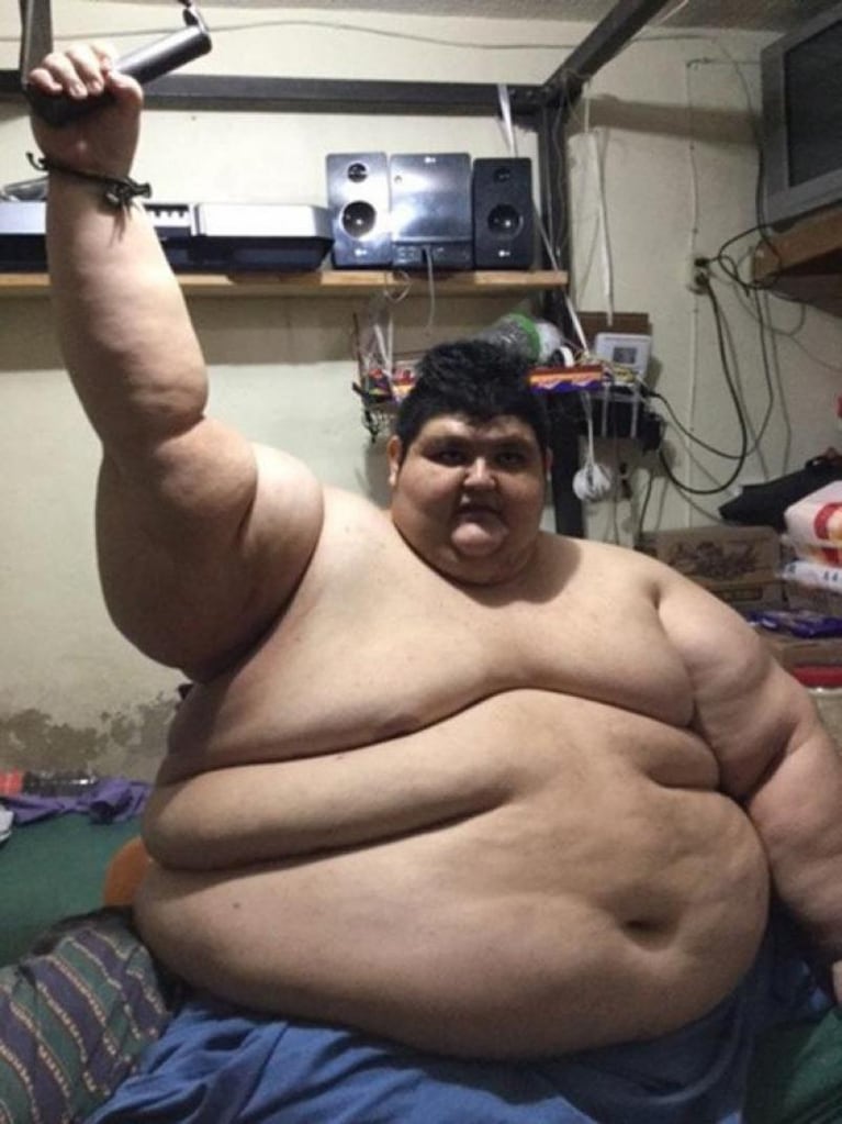 El hombre más obeso del mundo recibirá tratamiento