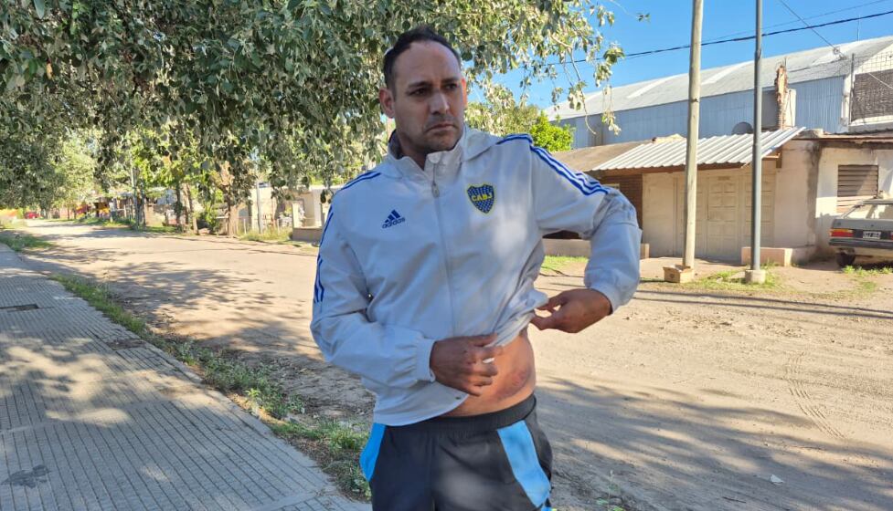 El hombre pasó cuatro días internado en una clínica cordobesa.