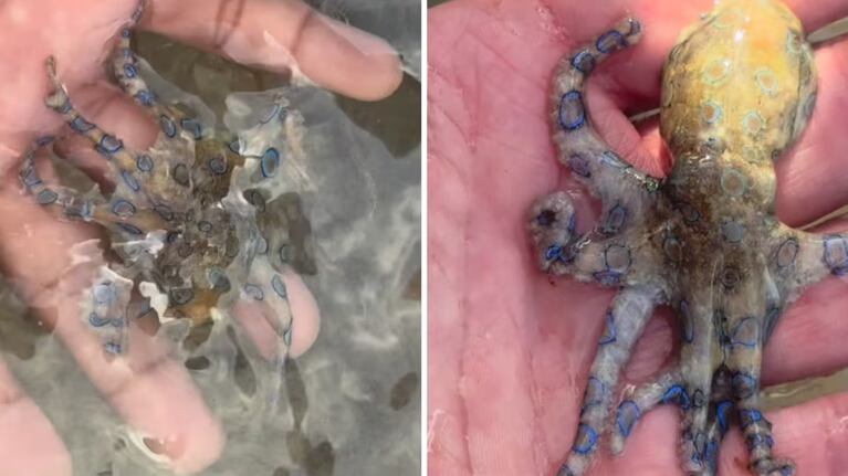 El hombre se salvó de milagro del pulpo venenoso.