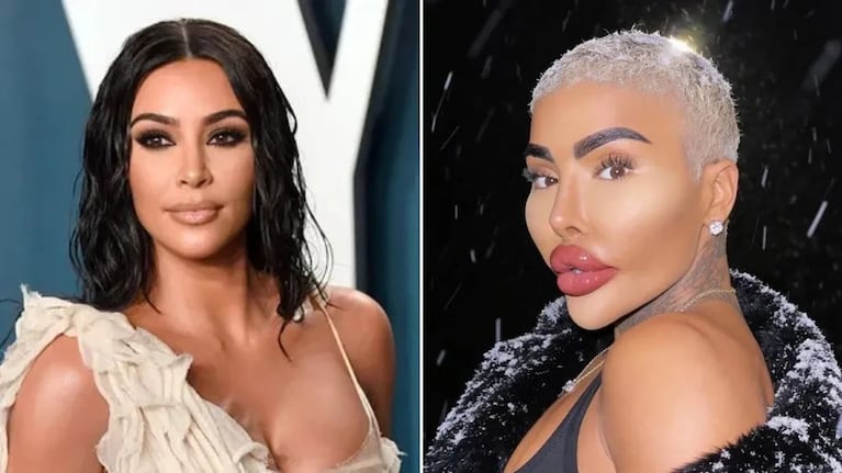 El influencer buscaba parecerse a Kim Kardashian.
