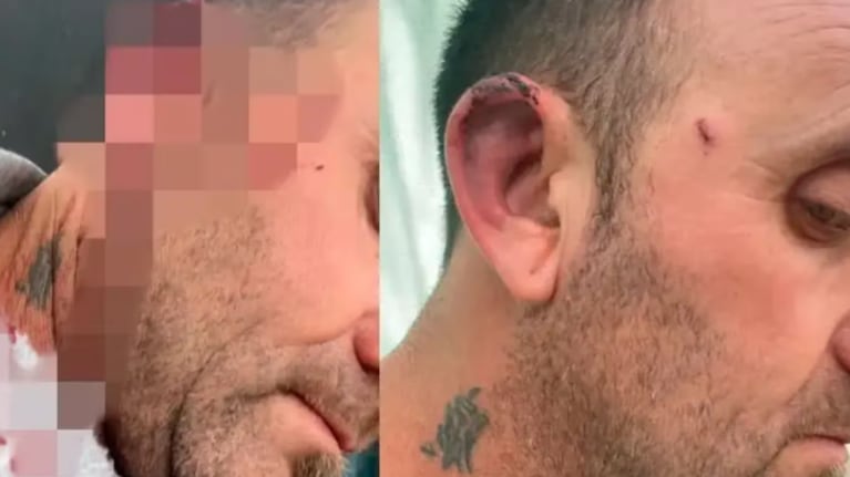 El intendente recibió una golpiza de parte de un concejal de su partido.