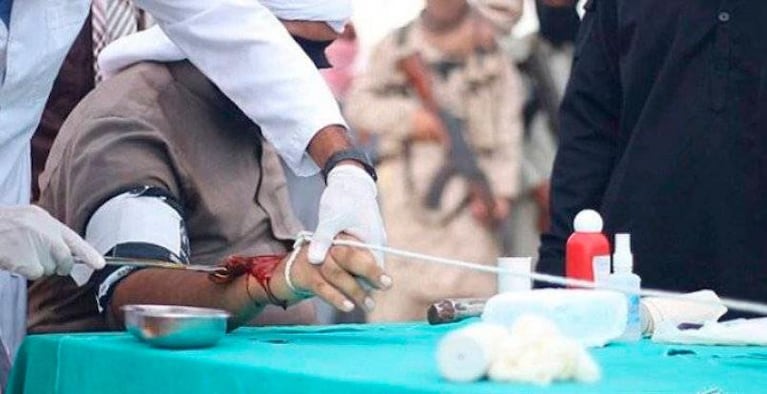 El ISIS amputó la mano de un ladrón con una cuchilla