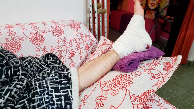El joven baleado se recupera en su casa.