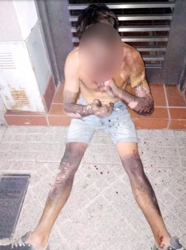 El joven terminó hospitalizado tras la fuerte descarga ( foto:Infobae)