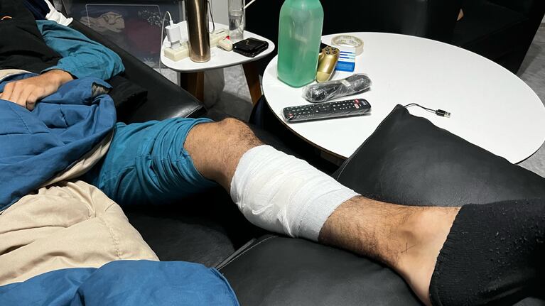 El joven tiene la bala alojada en la pierna.