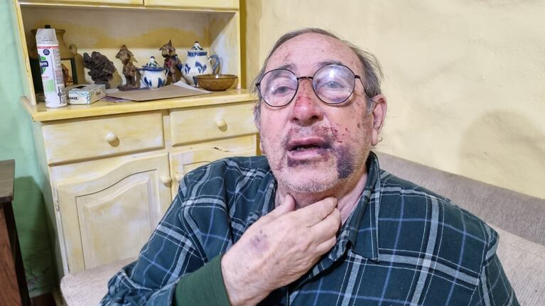 El jubilado de 77 años fue asaltado en su casa de Córdoba.