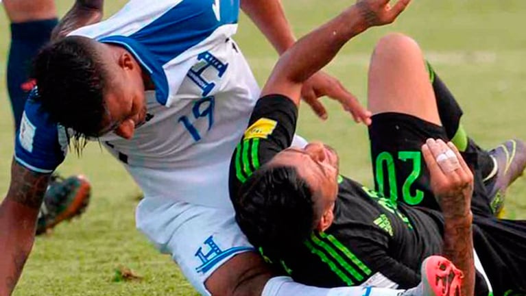 El jugador mexicano Aquino cayó sobre la pierna derecha de Garrido.