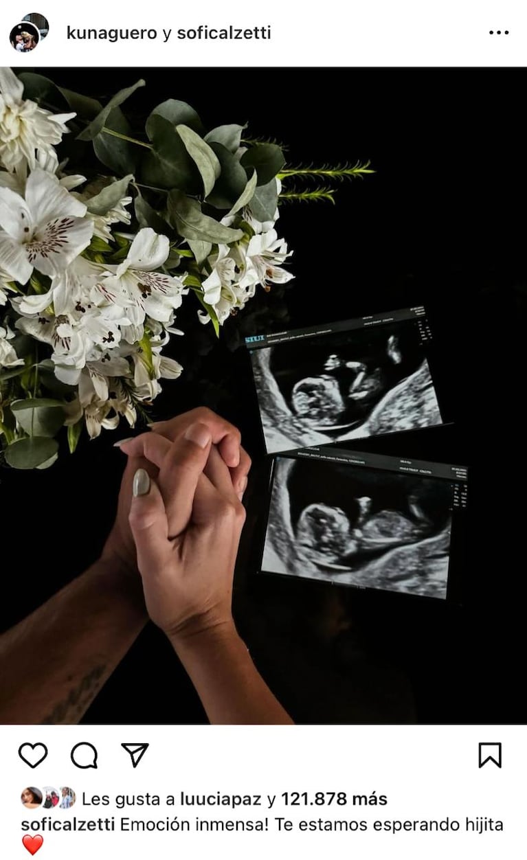 El Kun Agüero confirmó que espera su primera hija junto a Sofía Calzetti. (Foto: IG soficalzetti).