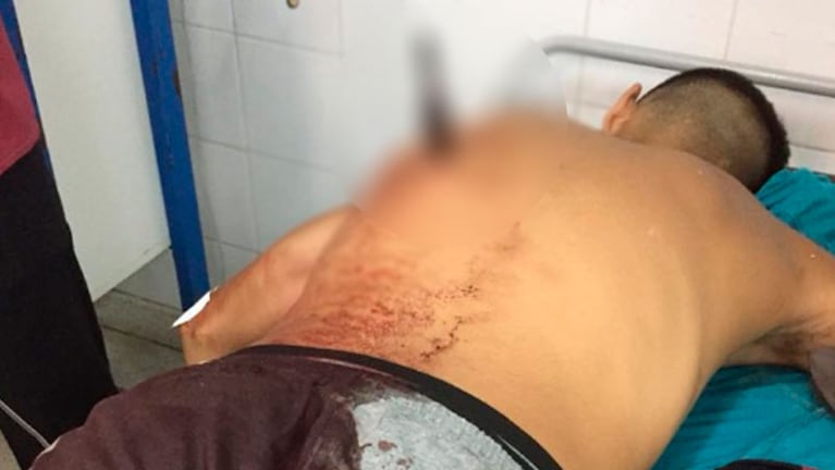 El ladrón de 16 años recibió una puñalada por la espalda.
