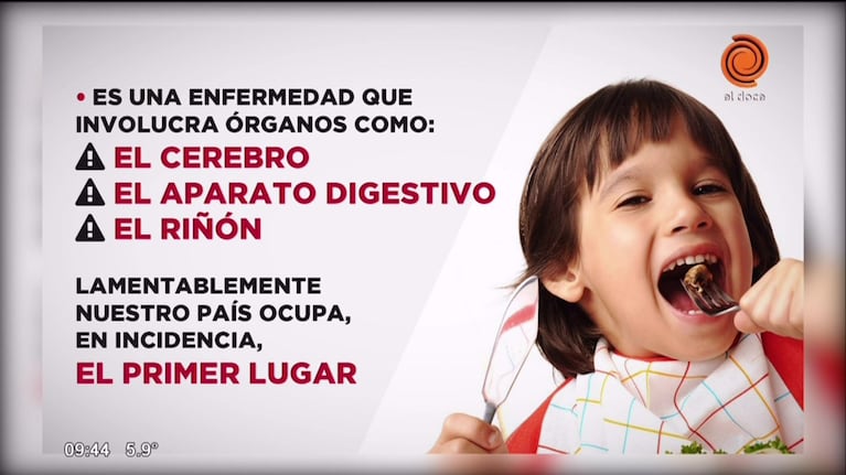 El mal de la carne cruda