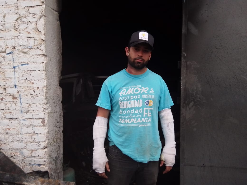 El mecánico sufrió quemaduras de primer y segundo grado. 