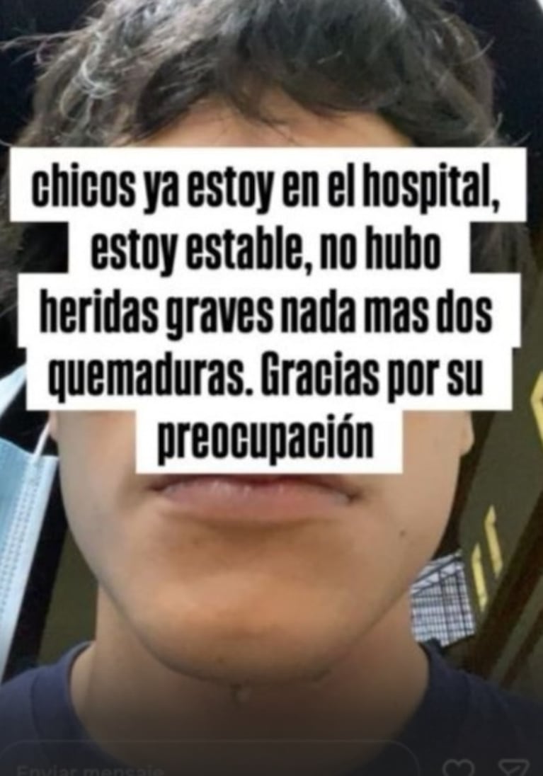 El mensaje del cantante tras el accidente.