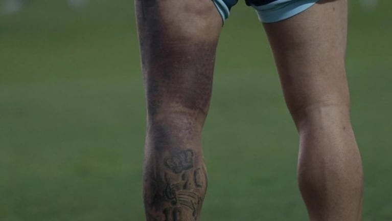 El moretón en el isquiotibial izquierdo de Rodrigo De Paul.