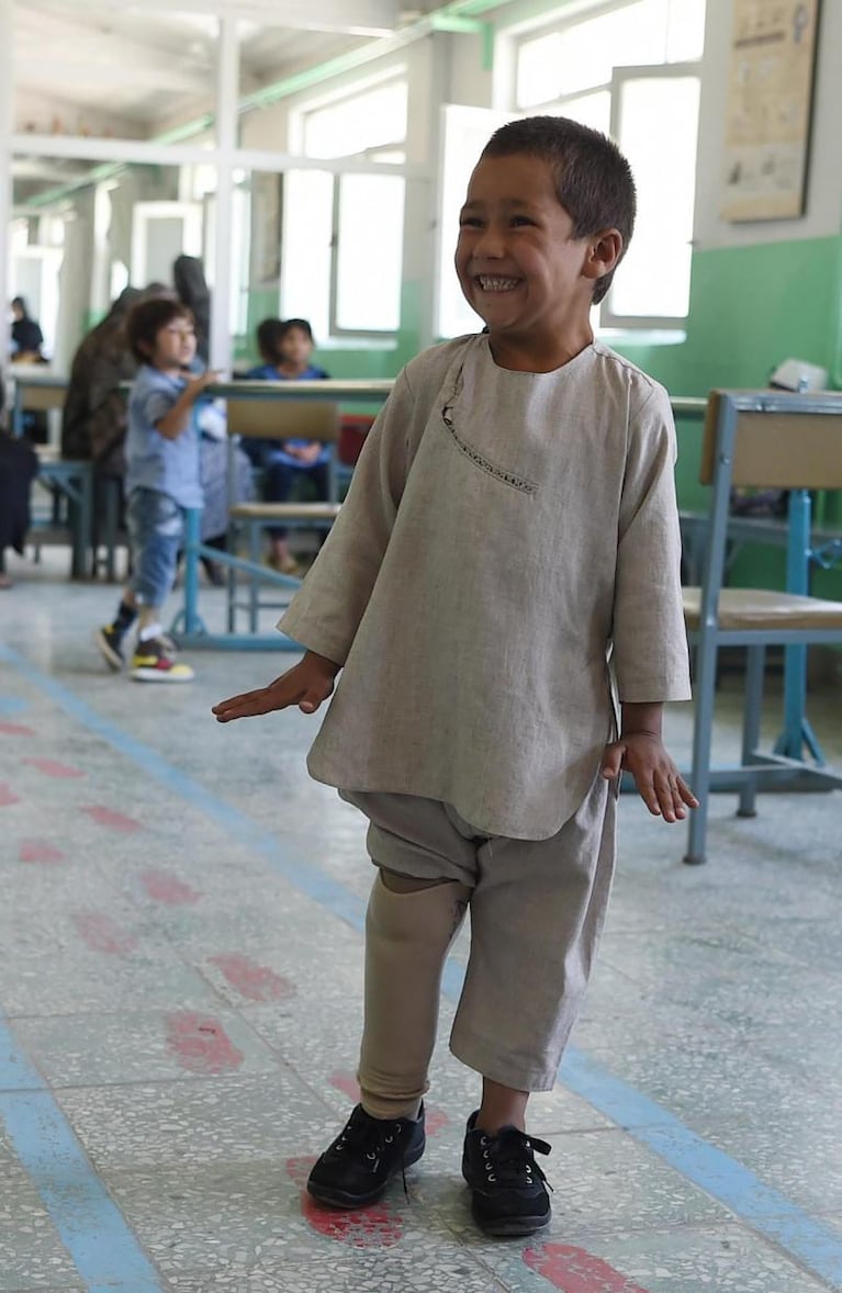 El nene amputado por la guerra en Afganistán baila feliz con su pierna nueva 