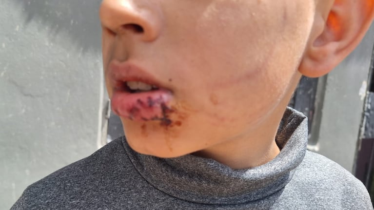El nene fue atacado cuando buscaba la pelota.