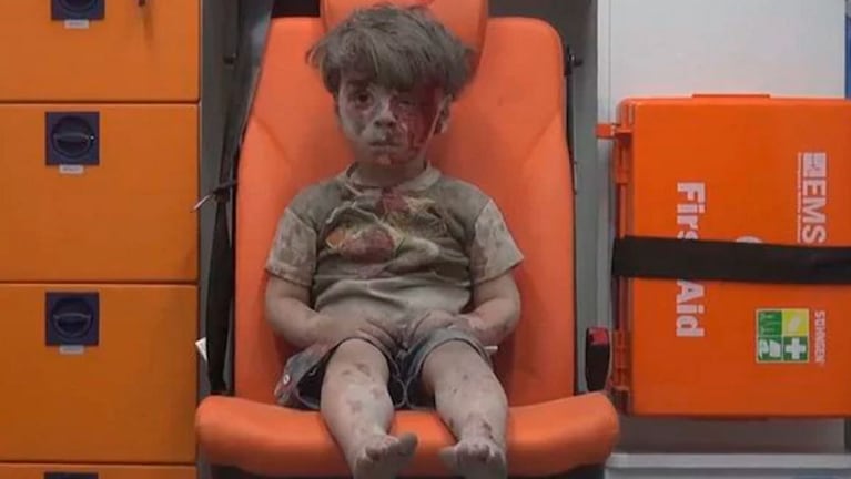 El nene sirio se repone de aquel estado que conmovió al mundo.
