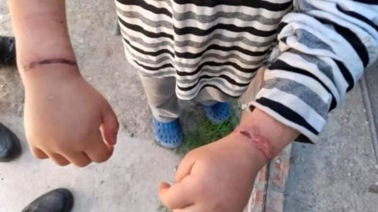 El nenito estaba atado con alambres.