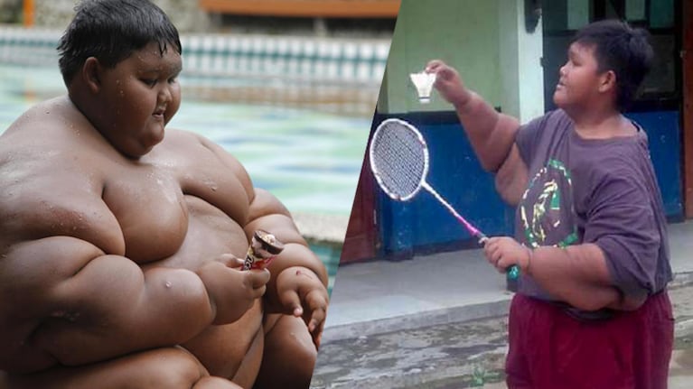El niño con mayor obesidad del mundo, ya no es tal.