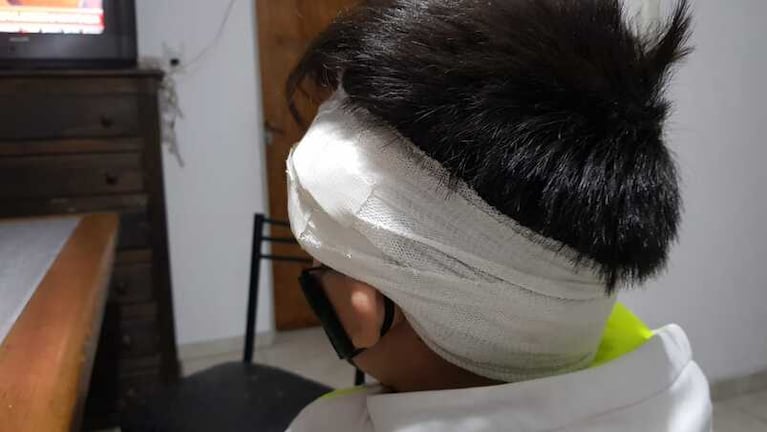 El niño de diez tiene cortes en su cabeza tras el impacto