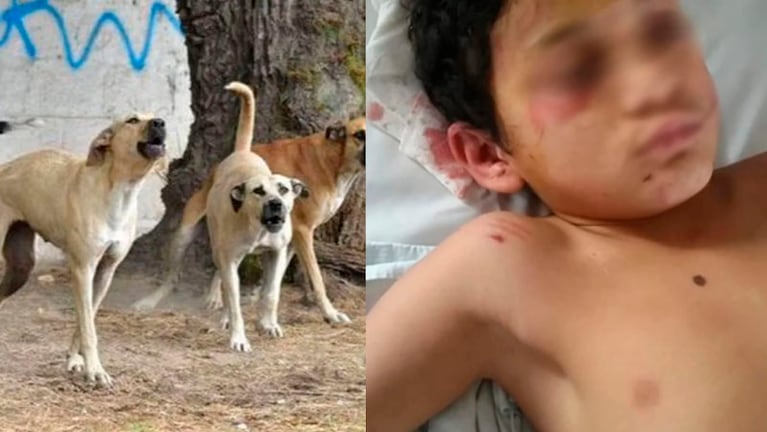 El niño fue atacado por una jauría de 16 perros.