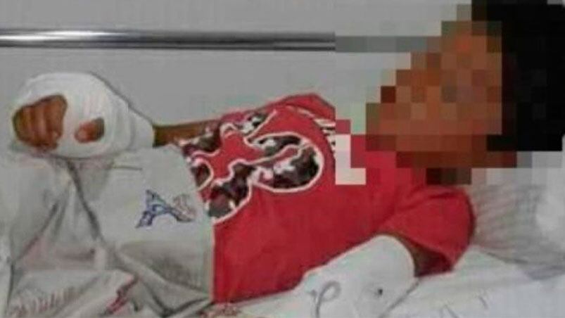 El niño herido está fuera de peligro y se recupera en un hospital de San Pedro.