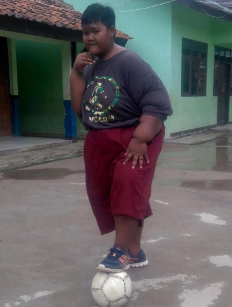 El niño más obeso del mundo bajó 70 kilos en nueve meses