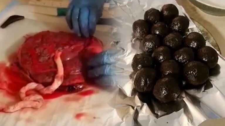 El paso a paso para hacer bombones con placenta.