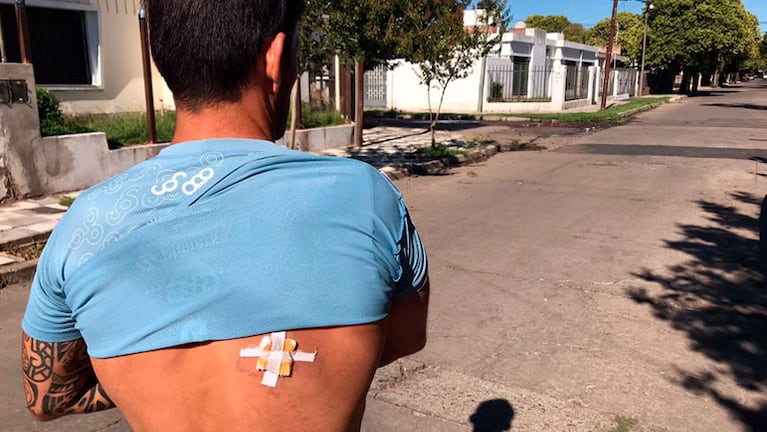 El perdigón impactó en su espalda. Foto: Andrés Ferreyra/El Doce
