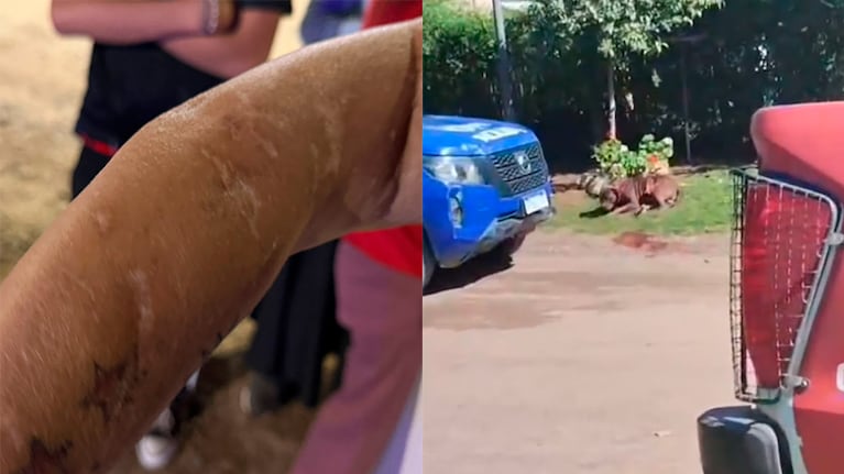 El pitbull de Villa Allende ya había atacado en 2024 a una vecina.