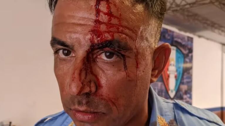 El policía herido recibió tres puntos en la frente.
