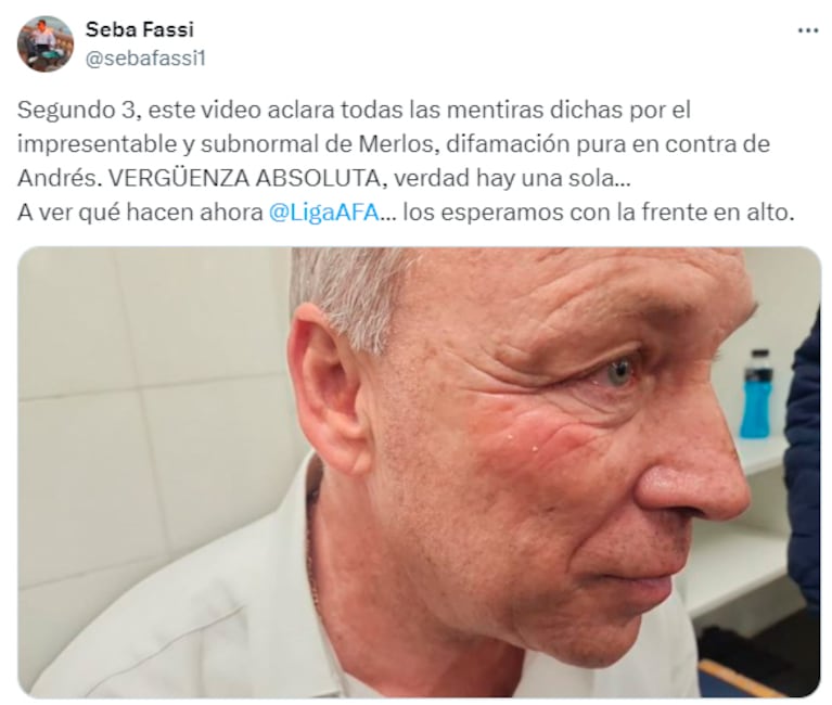 El posteo del hijo de Andrés Fassi.