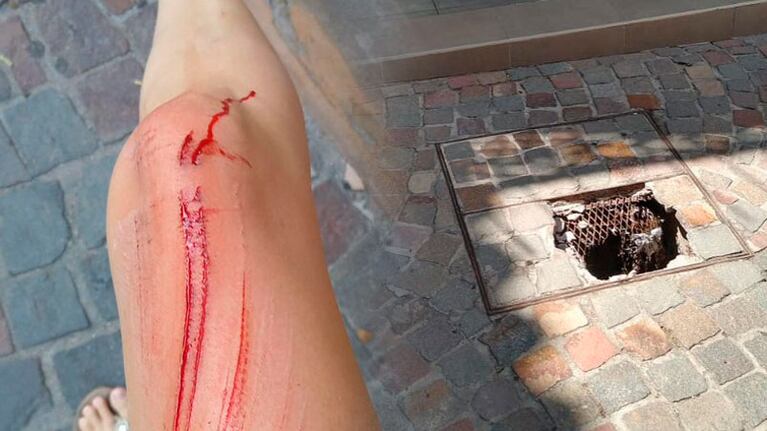 El pozo al que cayó y le dejó heridas en su pierna.