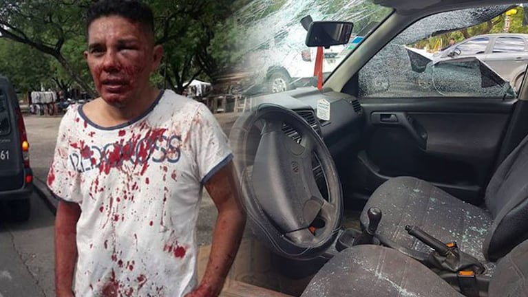 El resultado de la brutal agresión que sufrió un hombre a la salida de un boliche.