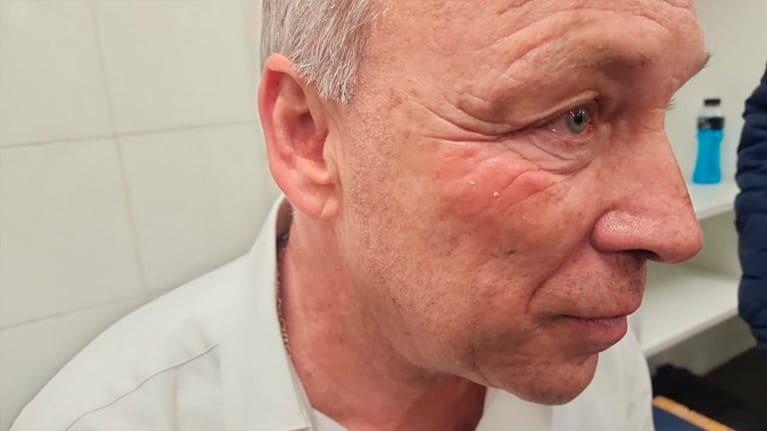El rostro de Fassi después del escándalo con el árbitro Merlos.