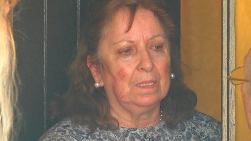 El rostro de la jubilada de Las Higueras muestra el salvaje ataque de los ladrones. Foto: Telediariodigital. 