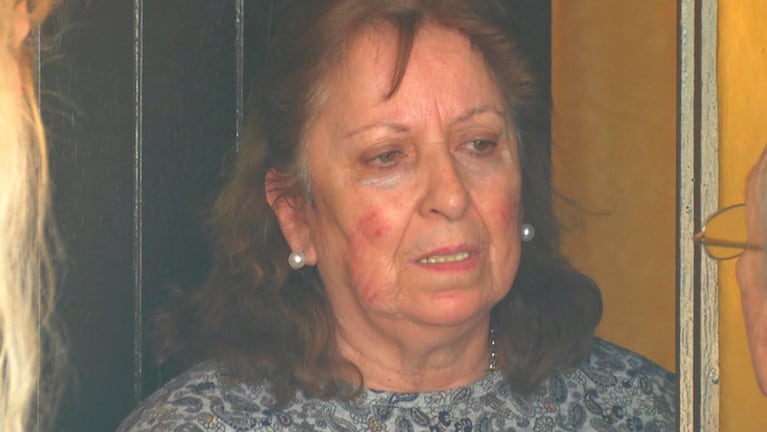El rostro de la jubilada de Las Higueras muestra el salvaje ataque de los ladrones. Foto: Telediariodigital. 