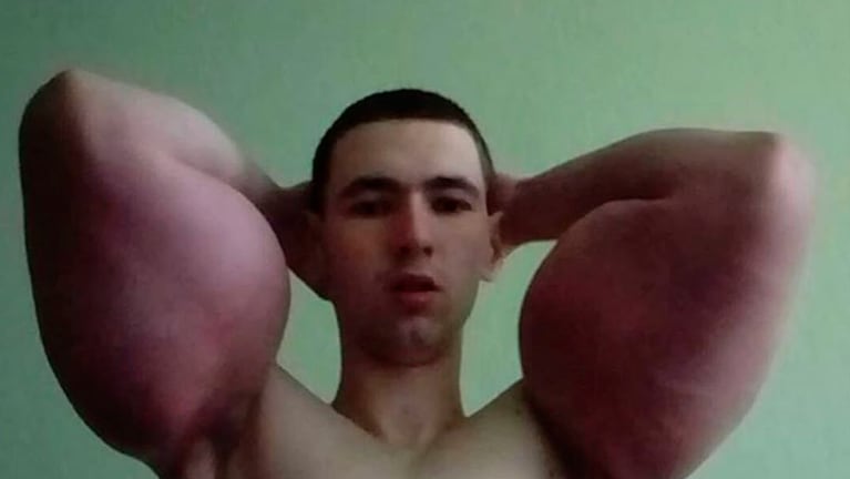 El ruso Kirill luce orgulloso sus biceps "recargados" de aceite.