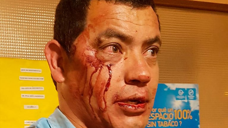 El sargento Herrera sufrió heridas en su rostro. 