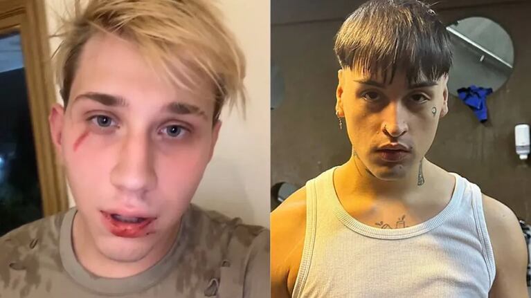 El streamer Brunenger denunció que fue golpeado por Tiago PZK y sus amigos y el cantante le respondió