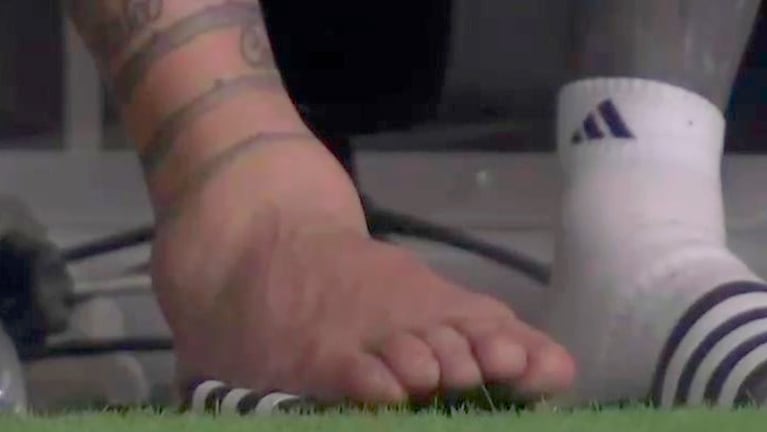 El tobillo derecho de Messi tras salir reemplazado.