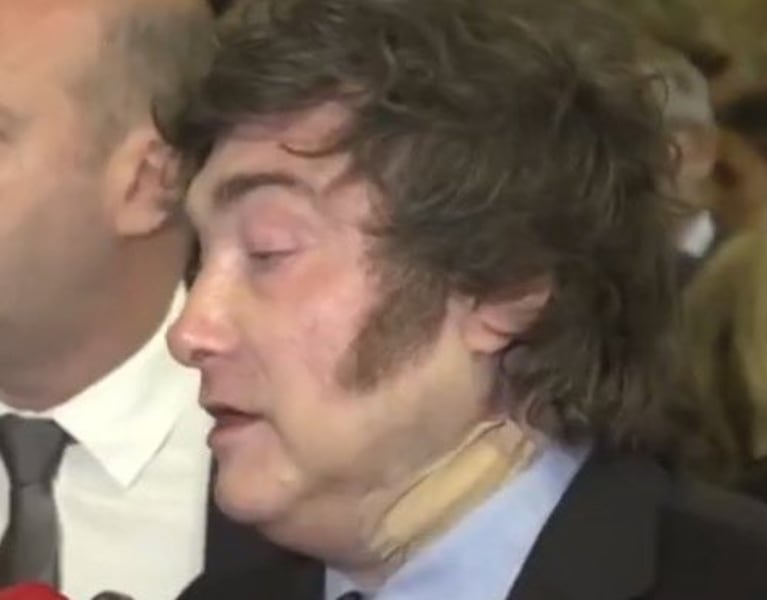 El vendaje en el cuello de Milei que llamó la atención durante su viaje por España