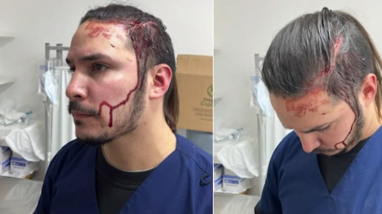 El veterinario sufrió un golpe en la cabeza por parte del dueño de una perra que murió en una cirugía.