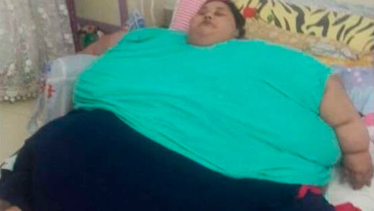 Eman Ahmed Abd El Aty se rindió en su lucha contra la obesidad.