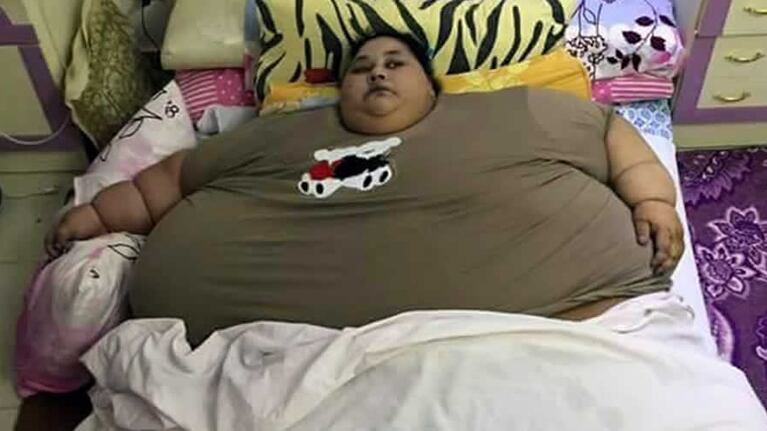 Eman Ahmed ya perdió la mitad de su peso.