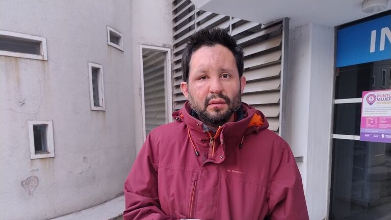 Emanuel sufrió quemaduras en la cara y en una mano.