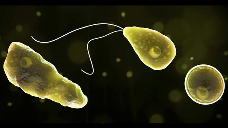 Esta rara enfermedad produce inflamación del cerebro y destrucción del tejido cerebral.