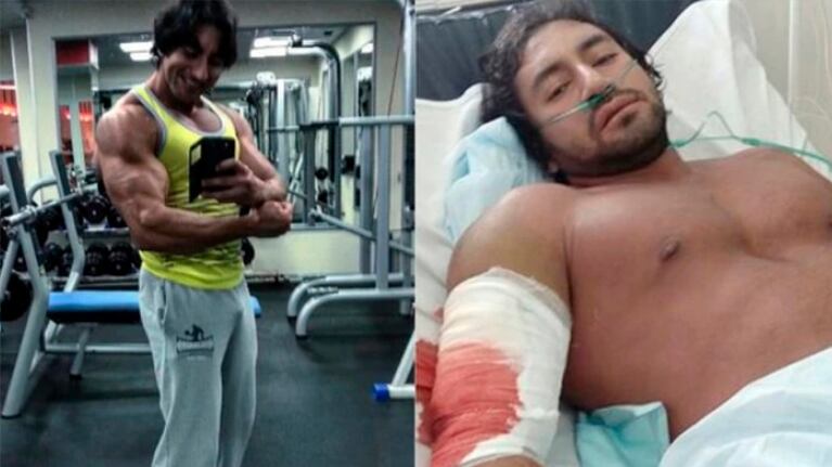 Existe una acusación de negligencia a los médicos por la infección de una bacteria durante el tratamiento.