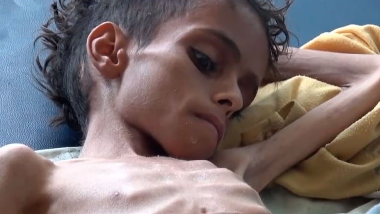 Ghazi Saleh, el nuevo símbolo del hambre y la guerra en Yemen. 