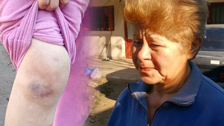 Gladys Pino sufrió una asalto traumático en barrio Virgen de Fátima.