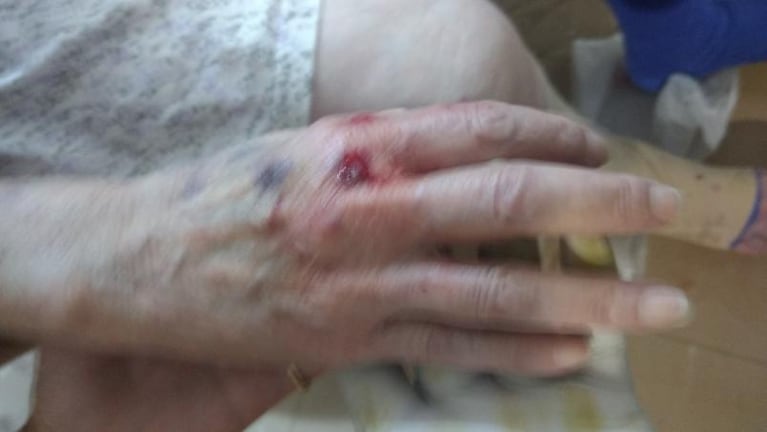 Golpearon brutalmente a una abuela de 79 años en un asalto
